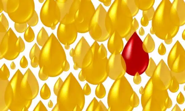 Sang dans les urines pourquoi faut-il consulter